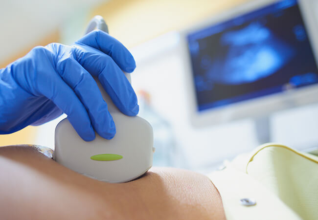 エコー検査(心血管・腹部)